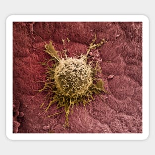 Bone marrow stem cell on cartilage, SEM (C019/7222) Sticker